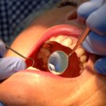 nottingham universitesinden dis minesini onaran yeni jel eSmu5AUY.jpg