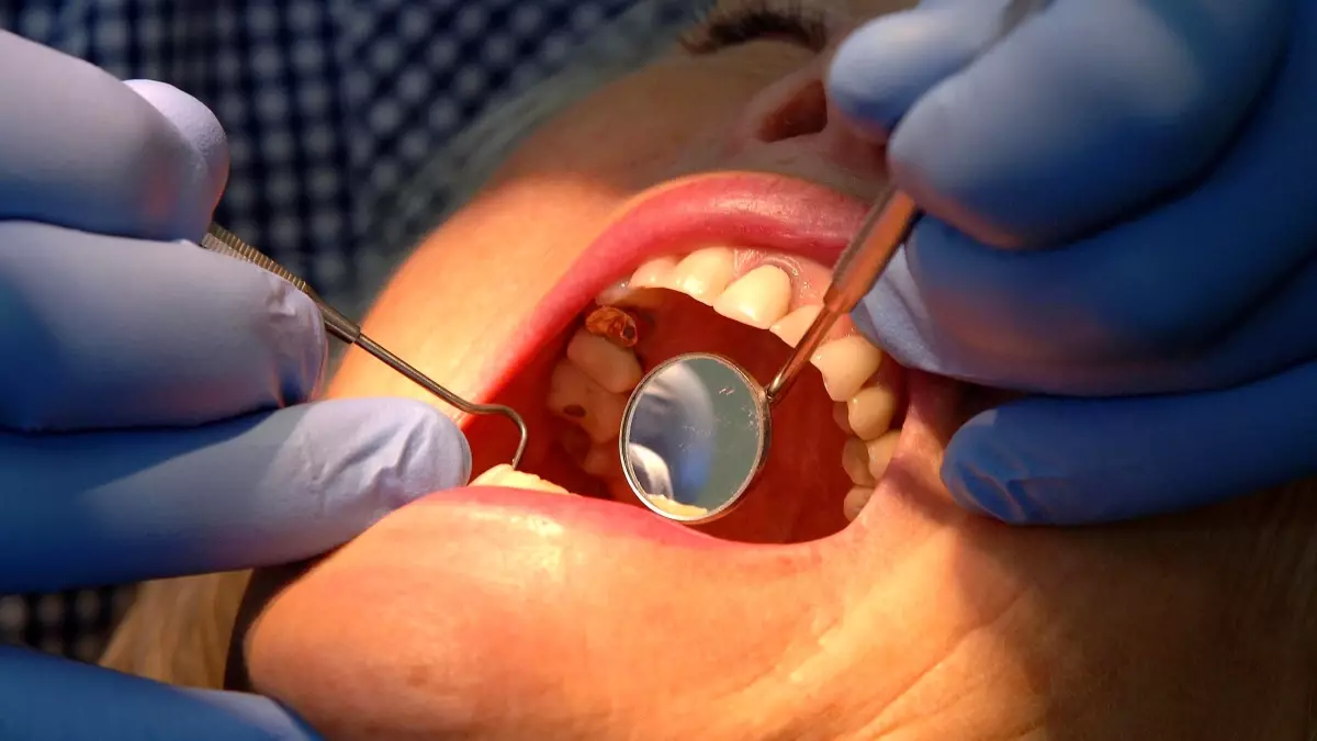 nottingham universitesinden dis minesini onaran yeni jel eSmu5AUY.jpg