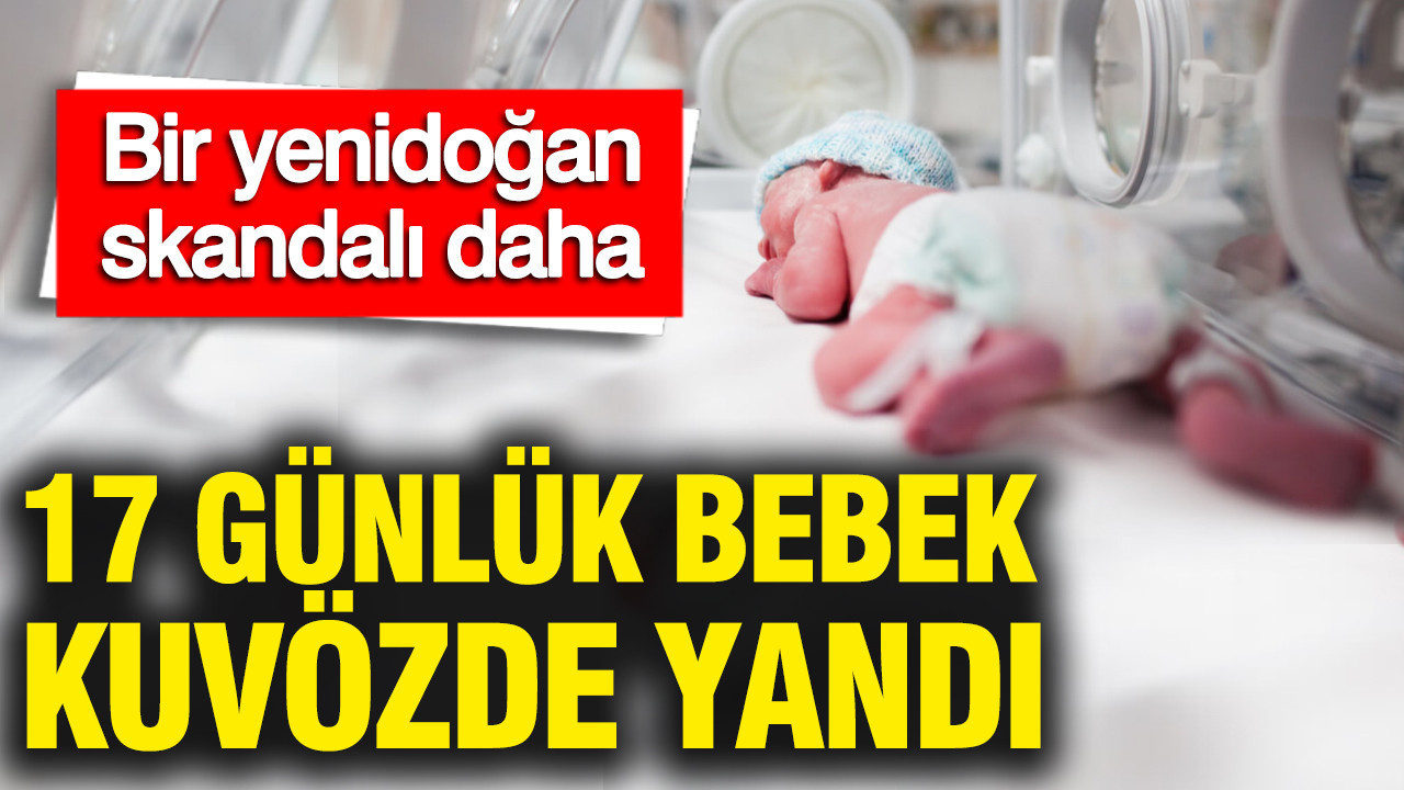 Yenidoğan Yoğun Bakımında İhmal: 17 Günlük Bebek Yanıklarla Hastaneye Sevk Edildi